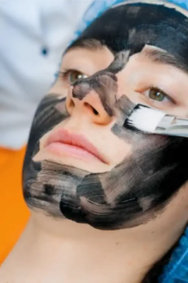 Carbon facial