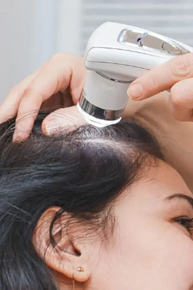 Exosome Therapy for Hair