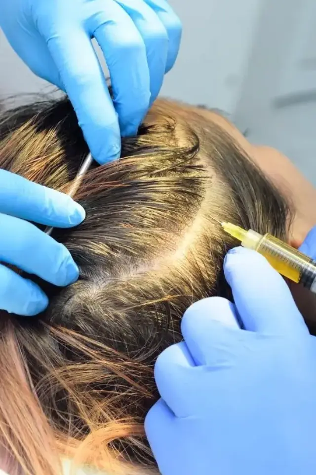 PRP Hair Therapy